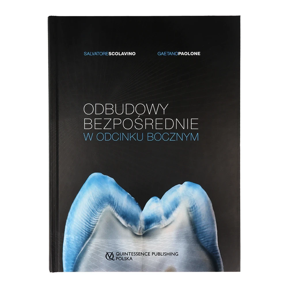 Odbudowy bezpośrednie w odcinku bocznym 1.webp