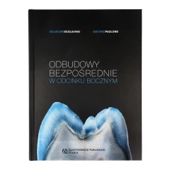 Odbudowy bezpośrednie w odcinku bocznym 1.webp