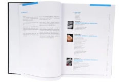 Odbudowy bezpośrednie w odcinku bocznym 4.webp