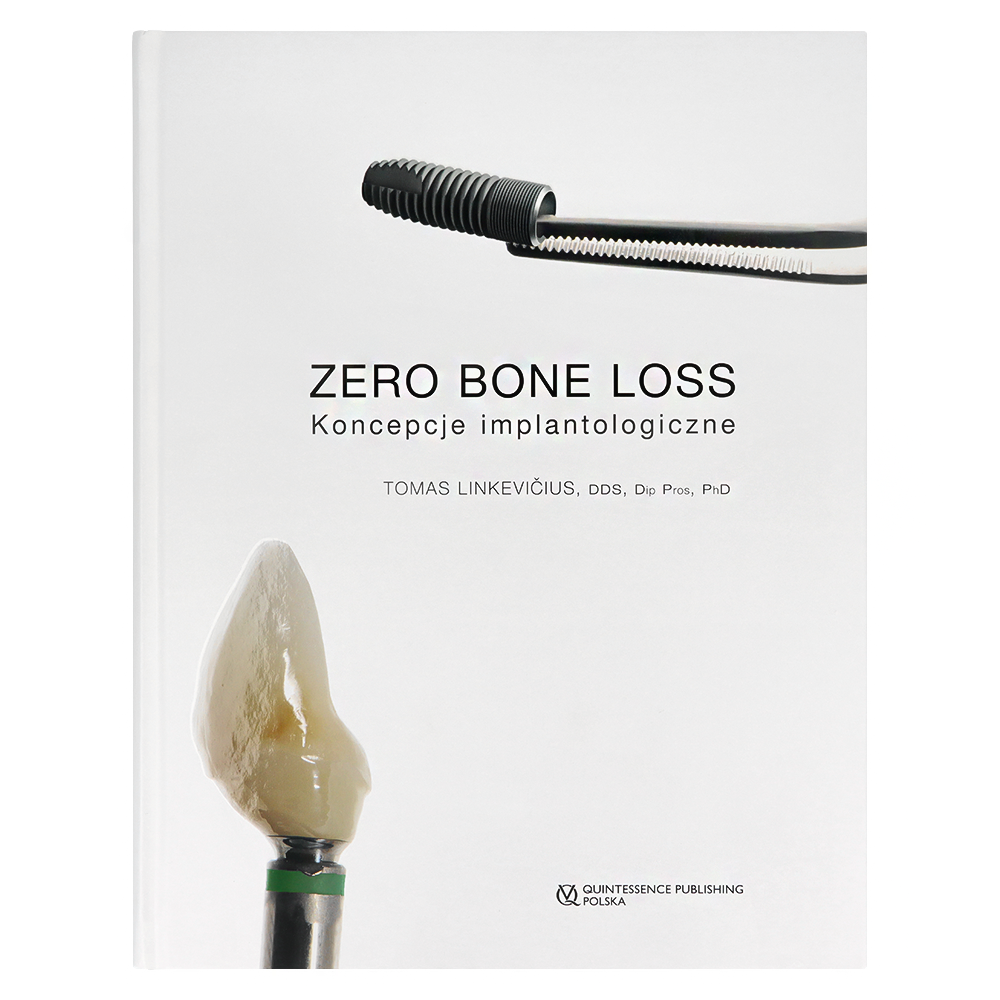 ZERO BONE LOSS koncepcje implantolog. Quintessence - 52828_1_kwadrat.webp